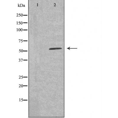 DF3569 staining HepG2 cells by IF/ICC. The sample were fixed with PFA and permeabilized in 0.1% Triton X-100,then blocked in 10% serum for 45 minutes at 25¡ãC. The primary antibody was diluted at 1/200 and incubated with the sample for 1 hour at 37¡ãC. An  Alexa Fluor 594 conjugated goat anti-rabbit IgG (H+L) antibody(Cat.# S0006), diluted at 1/600, was used as secondary antibod