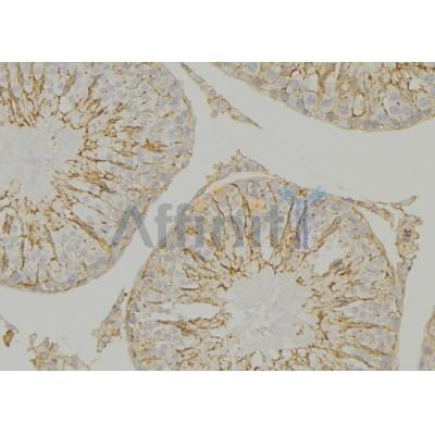DF3570 at 1/100 staining Mouse testis tissue by IHC-P. The sample was formaldehyde fixed and a heat mediated antigen retrieval step in citrate buffer was performed. The sample was then blocked and incubated with the antibody for 1.5 hours at 22¡ãC. An HRP conjugated goat anti-rabbit antibody was used as the secondary