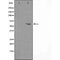 DF3571 staining HeLa by IF/ICC. The sample were fixed with PFA and permeabilized in 0.1% Triton X-100,then blocked in 10% serum for 45 minutes at 25¡ãC. The primary antibody was diluted at 1/200 and incubated with the sample for 1 hour at 37¡ãC. An  Alexa Fluor 594 conjugated goat anti-rabbit IgG (H+L) Ab, diluted at 1/600, was used as the secondary antibod