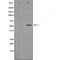 DF3577 staining  HT29 cells by IF/ICC. The sample were fixed with PFA and permeabilized in 0.1% Triton X-100,then blocked in 10% serum for 45 minutes at 25¡ãC. The primary antibody was diluted at 1/200 and incubated with the sample for 1 hour at 37¡ãC. An  Alexa Fluor 594 conjugated goat anti-rabbit IgG (H+L) antibody(Cat.