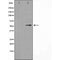 DF3580 at 1/100 staining Mouse muscle tissue by IHC-P. The sample was formaldehyde fixed and a heat mediated antigen retrieval step in citrate buffer was performed. The sample was then blocked and incubated with the antibody for 1.5 hours at 22¡ãC. An HRP conjugated goat anti-rabbit antibody was used as the secondary