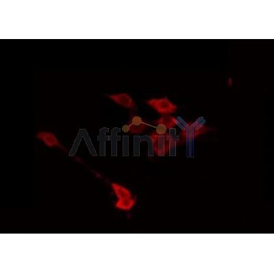 AF0367 staining HuvEc by IF/ICC. The sample were fixed with PFA and permeabilized in 0.1% Triton X-100,then blocked in 10% serum for 45 minutes at 25¡ãC. The primary antibody was diluted at 1/200 and incubated with the sample for 1 hour at 37¡ãC. An  Alexa Fluor 594 conjugated goat anti-rabbit IgG (H+L) Ab, diluted at 1/600, was used as the secondary antibod