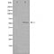 DF3583 staining HepG2 by IF/ICC. The sample were fixed with PFA and permeabilized in 0.1% Triton X-100,then blocked in 10% serum for 45 minutes at 25¡ãC. The primary antibody was diluted at 1/200 and incubated with the sample for 1 hour at 37¡ãC. An  Alexa Fluor 594 conjugated goat anti-rabbit IgG (H+L) Ab, diluted at 1/600, was used as the secondary antibod