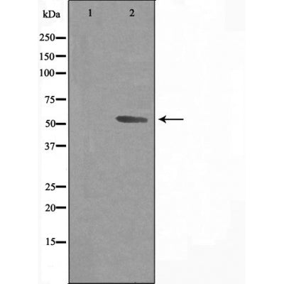 DF3584 staining Hela cells by IF/ICC. The sample were fixed with PFA and permeabilized in 0.1% Triton X-100,then blocked in 10% serum for 45 minutes at 25¡ãC. The primary antibody was diluted at 1/200 and incubated with the sample for 1 hour at 37¡ãC. An  Alexa Fluor 594 conjugated goat anti-rabbit IgG (H+L) antibody(Cat.# S0006), diluted at 1/600, was used as secondary antibod