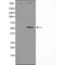 DF3584 staining Hela cells by IF/ICC. The sample were fixed with PFA and permeabilized in 0.1% Triton X-100,then blocked in 10% serum for 45 minutes at 25¡ãC. The primary antibody was diluted at 1/200 and incubated with the sample for 1 hour at 37¡ãC. An  Alexa Fluor 594 conjugated goat anti-rabbit IgG (H+L) antibody(Cat.# S0006), diluted at 1/600, was used as secondary antibod