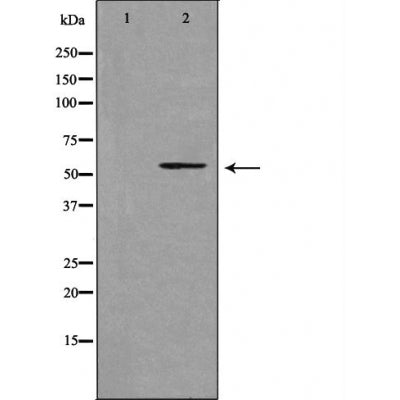 DF3585 staining LOVO cells by IF/ICC. The sample were fixed with PFA and permeabilized in 0.1% Triton X-100,then blocked in 10% serum for 45 minutes at 25¡ãC. The primary antibody was diluted at 1/200 and incubated with the sample for 1 hour at 37¡ãC. An  Alexa Fluor 594 conjugated goat anti-rabbit IgG (H+L) antibody(Cat.# S0006), diluted at 1/600, was used as secondary antibod