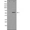 DF3585 staining LOVO cells by IF/ICC. The sample were fixed with PFA and permeabilized in 0.1% Triton X-100,then blocked in 10% serum for 45 minutes at 25¡ãC. The primary antibody was diluted at 1/200 and incubated with the sample for 1 hour at 37¡ãC. An  Alexa Fluor 594 conjugated goat anti-rabbit IgG (H+L) antibody(Cat.# S0006), diluted at 1/600, was used as secondary antibod