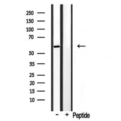 Western blot analysis of extracts from various samples, using Cytochrome P450 3A4/5 Antibody. Lane 1: Hela  treated with  blocking peptide; Lane 2: Hela; Lane 3: rat brain; 