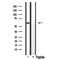 Western blot analysis of extracts from various samples, using Cytochrome P450 3A4/5 Antibody. Lane 1: Hela  treated with  blocking peptide; Lane 2: Hela; Lane 3: rat brain; 
