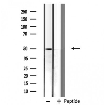 Western blot analysis of extracts from rat heart, using Cytochrome P450 3A4 Antibody. Lane 1 was treated with the blocking peptide.