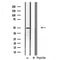 Western blot analysis of extracts from rat heart, using Cytochrome P450 3A4 Antibody. Lane 1 was treated with the blocking peptide.