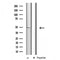 DF3588 at 1/100 staining Mouse liver tissue by IHC-P. The sample was formaldehyde fixed and a heat mediated antigen retrieval step in citrate buffer was performed. The sample was then blocked and incubated with the antibody for 1.5 hours at 22¡ãC. An HRP conjugated goat anti-rabbit antibody was used as the secondary