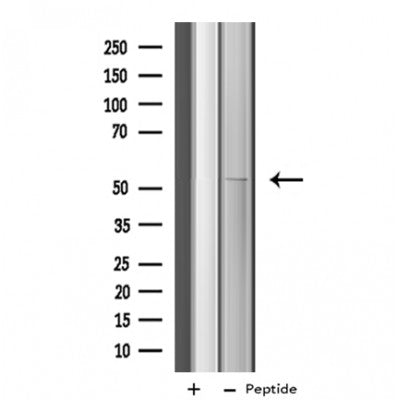 Western blot analysis of extracts from VERO, using Cytochrome P450 4X1 Antibody. The lane on the left was treated with blocking peptide.