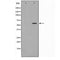 DF3590 staining HepG2 by IF/ICC. The sample were fixed with PFA and permeabilized in 0.1% Triton X-100,then blocked in 10% serum for 45 minutes at 25¡ãC. The primary antibody was diluted at 1/200 and incubated with the sample for 1 hour at 37¡ãC. An  Alexa Fluor 594 conjugated goat anti-rabbit IgG (H+L) Ab, diluted at 1/600, was used as the secondary antibod
