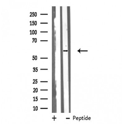 Western blot analysis of Cytochrome P450 51A1 using A431 whole cell lysates