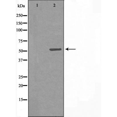 DF3592 staining LOVO cells by IF/ICC. The sample were fixed with PFA and permeabilized in 0.1% Triton X-100,then blocked in 10% serum for 45 minutes at 25¡ãC. The primary antibody was diluted at 1/200 and incubated with the sample for 1 hour at 37¡ãC. An  Alexa Fluor 594 conjugated goat anti-rabbit IgG (H+L) antibody(Cat.# S0006), diluted at 1/600, was used as secondary antibod