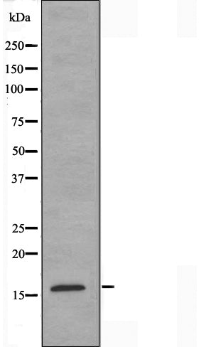 DF3593 at 1/100 staining Human Melanoma tissue by IHC-P. The sample was formaldehyde fixed and a heat mediated antigen retrieval step in citrate buffer was performed. The sample was then blocked and incubated with the antibody for 1.5 hours at 22¡ãC. An HRP conjugated goat anti-rabbit antibody was used as the secondary