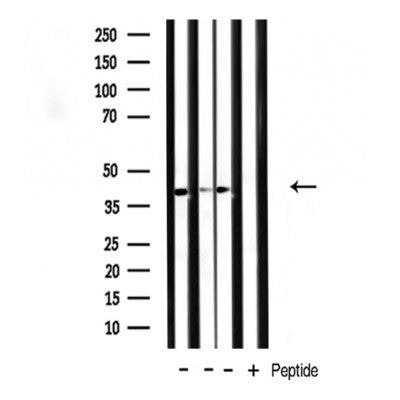 DF3594 staining HepG2 cells by IF/ICC. The sample were fixed with PFA and permeabilized in 0.1% Triton X-100,then blocked in 10% serum for 45 minutes at 25¡ãC. The primary antibody was diluted at 1/200 and incubated with the sample for 1 hour at 37¡ãC. An  Alexa Fluor 594 conjugated goat anti-rabbit IgG (H+L) antibody(Cat.# S0006), diluted at 1/600, was used as secondary antibod