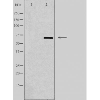 DF3598 staining HuvEc cells by IF/ICC. The sample were fixed with PFA and permeabilized in 0.1% Triton X-100,then blocked in 10% serum for 45 minutes at 25¡ãC. The primary antibody was diluted at 1/200 and incubated with the sample for 1 hour at 37¡ãC. An  Alexa Fluor 594 conjugated goat anti-rabbit IgG (H+L) antibody(Cat.# S0006), diluted at 1/600, was used as secondary antibod