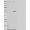 DF3598 staining HuvEc cells by IF/ICC. The sample were fixed with PFA and permeabilized in 0.1% Triton X-100,then blocked in 10% serum for 45 minutes at 25¡ãC. The primary antibody was diluted at 1/200 and incubated with the sample for 1 hour at 37¡ãC. An  Alexa Fluor 594 conjugated goat anti-rabbit IgG (H+L) antibody(Cat.# S0006), diluted at 1/600, was used as secondary antibod