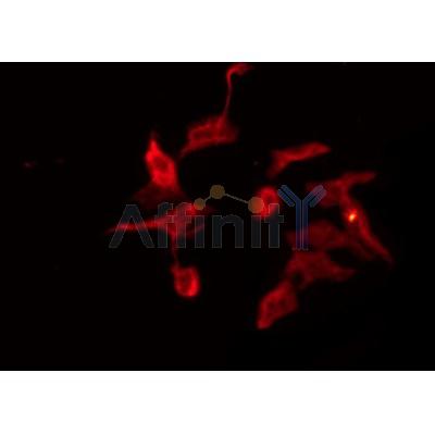 Western blot analysis of extracts from HepG2, using GRID2 Antibody. Lane 1 was treated with the blocking peptide.
