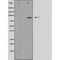 DF3602 staining LOVO by IF/ICC. The sample were fixed with PFA and permeabilized in 0.1% Triton X-100,then blocked in 10% serum for 45 minutes at 25¡ãC. The primary antibody was diluted at 1/200 and incubated with the sample for 1 hour at 37¡ãC. An  Alexa Fluor 594 conjugated goat anti-rabbit IgG (H+L) Ab, diluted at 1/600, was used as the secondary antibod