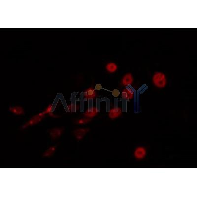 AF0372 staining LOVO by IF/ICC. The sample were fixed with PFA and permeabilized in 0.1% Triton X-100,then blocked in 10% serum for 45 minutes at 25¡ãC. The primary antibody was diluted at 1/200 and incubated with the sample for 1 hour at 37¡ãC. An  Alexa Fluor 594 conjugated goat anti-rabbit IgG (H+L) Ab, diluted at 1/600, was used as the secondary antibod