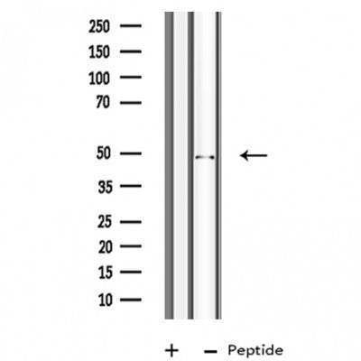 DF3604 staining  A549 cells by IF/ICC. The sample were fixed with PFA and permeabilized in 0.1% Triton X-100,then blocked in 10% serum for 45 minutes at 25¡ãC. The primary antibody was diluted at 1/200 and incubated with the sample for 1 hour at 37¡ãC. An  Alexa Fluor 594 conjugated goat anti-rabbit IgG (H+L) antibody(Cat.# S0006), diluted at 1/600, was used as secondary antibod