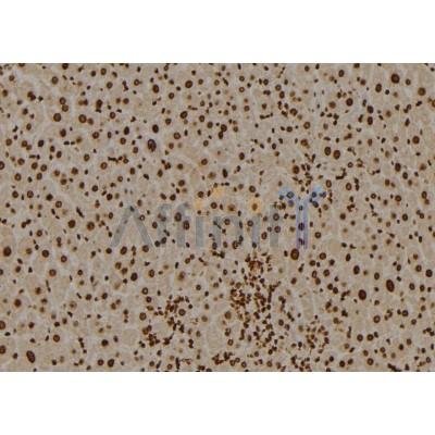Western blot analysis of extracts from rat brain, using BCL10 Antibody. Lane 1 was treated with the blocking peptide.
