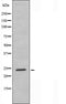 DF3607 staining COLO205 cells by IF/ICC. The sample were fixed with PFA and permeabilized in 0.1% Triton X-100,then blocked in 10% serum for 45 minutes at 25¡ãC. The primary antibody was diluted at 1/200 and incubated with the sample for 1 hour at 37¡ãC. An  Alexa Fluor 594 conjugated goat anti-rabbit IgG (H+L) antibody(Cat.# S0006), diluted at 1/600, was used as secondary antibod