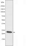 DF3608 at 1/100 staining Mouse liver tissue by IHC-P. The sample was formaldehyde fixed and a heat mediated antigen retrieval step in citrate buffer was performed. The sample was then blocked and incubated with the antibody for 1.5 hours at 22¡ãC. An HRP conjugated goat anti-rabbit antibody was used as the secondary