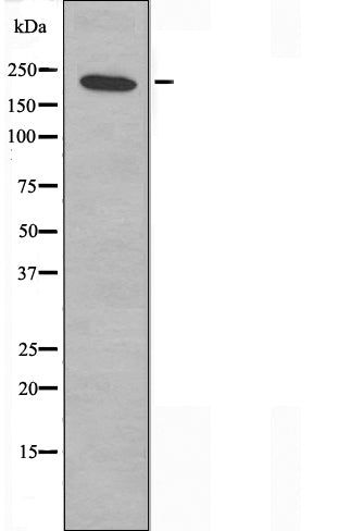 DF3612 staining  293 cells by IF/ICC. The sample were fixed with PFA and permeabilized in 0.1% Triton X-100,then blocked in 10% serum for 45 minutes at 25¡ãC. The primary antibody was diluted at 1/200 and incubated with the sample for 1 hour at 37¡ãC. An  Alexa Fluor 594 conjugated goat anti-rabbit IgG (H+L) antibody(Cat.# S0006), diluted at 1/600, was used as secondary antibod