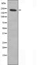 DF3612 staining  293 cells by IF/ICC. The sample were fixed with PFA and permeabilized in 0.1% Triton X-100,then blocked in 10% serum for 45 minutes at 25¡ãC. The primary antibody was diluted at 1/200 and incubated with the sample for 1 hour at 37¡ãC. An  Alexa Fluor 594 conjugated goat anti-rabbit IgG (H+L) antibody(Cat.# S0006), diluted at 1/600, was used as secondary antibod