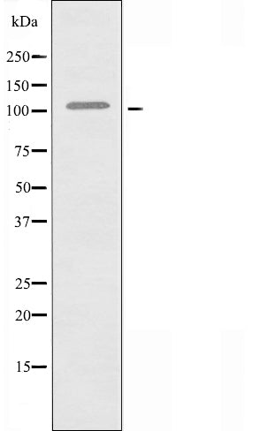 DF3613 staining HepG2? cells by IF/ICC. The sample were fixed with PFA and permeabilized in 0.1% Triton X-100,then blocked in 10% serum for 45 minutes at 25¡ãC. The primary antibody was diluted at 1/200 and incubated with the sample for 1 hour at 37¡ãC. An  Alexa Fluor 594 conjugated goat anti-rabbit IgG (H+L) antibody(Cat.# S0006), diluted at 1/600, was used as secondary antibod