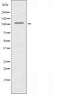 DF3613 staining HepG2? cells by IF/ICC. The sample were fixed with PFA and permeabilized in 0.1% Triton X-100,then blocked in 10% serum for 45 minutes at 25¡ãC. The primary antibody was diluted at 1/200 and incubated with the sample for 1 hour at 37¡ãC. An  Alexa Fluor 594 conjugated goat anti-rabbit IgG (H+L) antibody(Cat.# S0006), diluted at 1/600, was used as secondary antibod