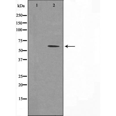 DF3614 staining COLO205 by IF/ICC. The sample were fixed with PFA and permeabilized in 0.1% Triton X-100,then blocked in 10% serum for 45 minutes at 25¡ãC. The primary antibody was diluted at 1/200 and incubated with the sample for 1 hour at 37¡ãC. An  Alexa Fluor 594 conjugated goat anti-rabbit IgG (H+L) Ab, diluted at 1/600, was used as the secondary antibod