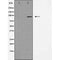 DF3615 staining A549 by IF/ICC. The sample were fixed with PFA and permeabilized in 0.1% Triton X-100,then blocked in 10% serum for 45 minutes at 25¡ãC. The primary antibody was diluted at 1/200 and incubated with the sample for 1 hour at 37¡ãC. An  Alexa Fluor 594 conjugated goat anti-rabbit IgG (H+L) Ab, diluted at 1/600, was used as the secondary antibod