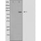 DF3616 staining A549 cells by IF/ICC. The sample were fixed with PFA and permeabilized in 0.1% Triton X-100,then blocked in 10% serum for 45 minutes at 25¡ãC. The primary antibody was diluted at 1/200 and incubated with the sample for 1 hour at 37¡ãC. An  Alexa Fluor 594 conjugated goat anti-rabbit IgG (H+L) antibody(Cat.# S0006), diluted at 1/600, was used as secondary antibod