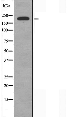 DF3617 at 1/100 staining Mouse testis tissue by IHC-P. The sample was formaldehyde fixed and a heat mediated antigen retrieval step in citrate buffer was performed. The sample was then blocked and incubated with the antibody for 1.5 hours at 22¡ãC. An HRP conjugated goat anti-rabbit antibody was used as the secondary
