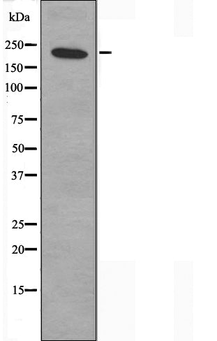 DF3618 at 1/100 staining Human uterus tissue by IHC-P. The sample was formaldehyde fixed and a heat mediated antigen retrieval step in citrate buffer was performed. The sample was then blocked and incubated with the antibody for 1.5 hours at 22¡ãC. An HRP conjugated goat anti-rabbit antibody was used as the secondary