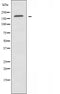 DF3619 staining HuvEc cells by IF/ICC. The sample were fixed with PFA and permeabilized in 0.1% Triton X-100,then blocked in 10% serum for 45 minutes at 25¡ãC. The primary antibody was diluted at 1/200 and incubated with the sample for 1 hour at 37¡ãC. An  Alexa Fluor 594 conjugated goat anti-rabbit IgG (H+L) antibody(Cat.# S0006), diluted at 1/600, was used as secondary antibod