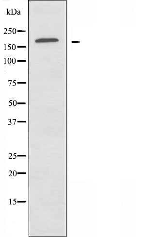 DF3619 staining HuvEc cells by IF/ICC. The sample were fixed with PFA and permeabilized in 0.1% Triton X-100,then blocked in 10% serum for 45 minutes at 25¡ãC. The primary antibody was diluted at 1/200 and incubated with the sample for 1 hour at 37¡ãC. An  Alexa Fluor 594 conjugated goat anti-rabbit IgG (H+L) antibody(Cat.