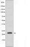 DF3620 staining Hela by IF/ICC. The sample were fixed with PFA and permeabilized in 0.1% Triton X-100,then blocked in 10% serum for 45 minutes at 25¡ãC. The primary antibody was diluted at 1/200 and incubated with the sample for 1 hour at 37¡ãC. An  Alexa Fluor 594 conjugated goat anti-rabbit IgG (H+L) Ab, diluted at 1/600, was used as the secondary antibod