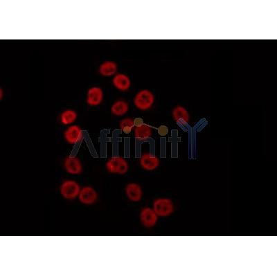 Western blot analysis of extracts from mouse lung, using MLH1 Antibody.