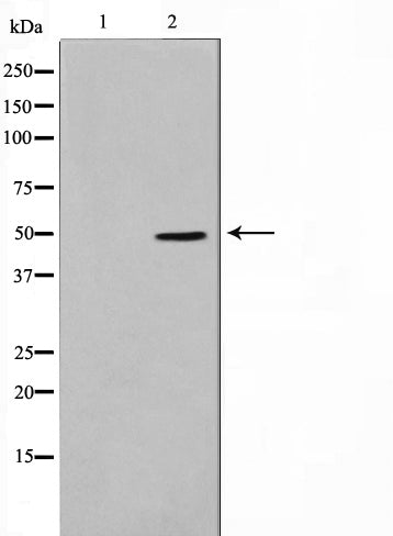 Western blot analysis on HepG2 cell lysate using SERC1 Antibody,The lane on the left is treated with the antigen-specific peptide.