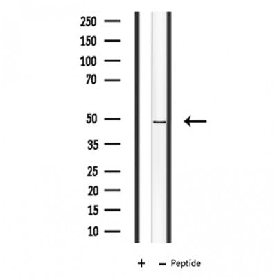 DF3628 staining  COLO205 cells by IF/ICC. The sample were fixed with PFA and permeabilized in 0.1% Triton X-100,then blocked in 10% serum for 45 minutes at 25¡ãC. The primary antibody was diluted at 1/200 and incubated with the sample for 1 hour at 37¡ãC. An  Alexa Fluor 594 conjugated goat anti-rabbit IgG (H+L) antibody(Cat.# S0006), diluted at 1/600, was used as secondary antibod