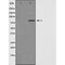 DF3631 staining HeLa by IF/ICC. The sample were fixed with PFA and permeabilized in 0.1% Triton X-100,then blocked in 10% serum for 45 minutes at 25¡ãC. The primary antibody was diluted at 1/200 and incubated with the sample for 1 hour at 37¡ãC. An  Alexa Fluor 594 conjugated goat anti-rabbit IgG (H+L) Ab, diluted at 1/600, was used as the secondary antibod