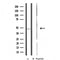 Western blot analysis of extracts from LOVO cells, using RAD23A antibody.