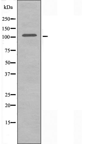 DF3637 staining  HepG2 cells by IF/ICC. The sample were fixed with PFA and permeabilized in 0.1% Triton X-100,then blocked in 10% serum for 45 minutes at 25¡ãC. The primary antibody was diluted at 1/200 and incubated with the sample for 1 hour at 37¡ãC. An  Alexa Fluor 594 conjugated goat anti-rabbit IgG (H+L) antibody(Cat.# S0006), diluted at 1/600, was used as secondary antibod
