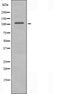 DF3637 staining  HepG2 cells by IF/ICC. The sample were fixed with PFA and permeabilized in 0.1% Triton X-100,then blocked in 10% serum for 45 minutes at 25¡ãC. The primary antibody was diluted at 1/200 and incubated with the sample for 1 hour at 37¡ãC. An  Alexa Fluor 594 conjugated goat anti-rabbit IgG (H+L) antibody(Cat.# S0006), diluted at 1/600, was used as secondary antibod